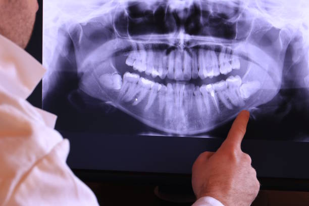 Best Emergency Treatment for Dental Infections or Abscesses in Hyde Rk, PA